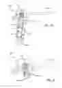 Fig. 41 - Surgical frame facilitating articulatable support for a patient during surgery