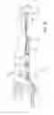 Fig. 43 - Surgical frame facilitating articulatable support for a patient during surgery