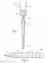 Fig. 02 - ENDODONTIC POST AND OBTURATOR
