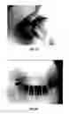 Fig. 02 - ACTIVE COMBINATIONS, COMPOSITIONS AND METHODS FOR ENHANCING HAIR GROWTH