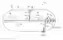 Fig. 01 - Methods for delivering insulin preparations into a lumen of the intestinal tract using a swallowable drug delivery device