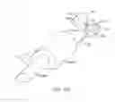 Fig. 22 - Methods for delivering insulin preparations into a lumen of the intestinal tract using a swallowable drug delivery device