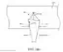 Fig. 35 - Methods for delivering insulin preparations into a lumen of the intestinal tract using a swallowable drug delivery device