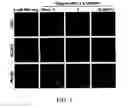 Fig. 02 - Methods for inhibiting expression of ASC, expression of NLRP3, and/or formation of NLRP3 inflammasome complex using diacerein or its analogs