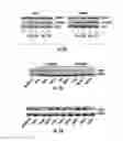 Fig. 13 - Histone deacetylase as a modulator of PDL1 expression and activity