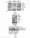 Fig. 24 - Histone deacetylase as a modulator of PDL1 expression and activity