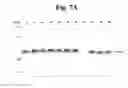 Fig. 17 - FLAGELLAR AND NEEDLE COMPLEX (INJECTOSOME) LOOP AS ANTI BACTERIAL DRUG TARGET