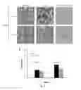 Fig. 03 - Use of ginsenoside M1 for treating lupus nephritis