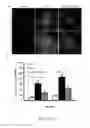 Fig. 06 - Use of ginsenoside M1 for treating lupus nephritis