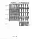Fig. 07 - KAPPA/LAMBDA CHIMERIC ANTIGEN RECEPTORS