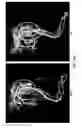 Fig. 06 - METHODS OF ENHANCING STEM CELL ENGRAFTMENT