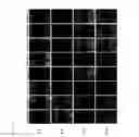 Fig. 04 - Pharmaceutical composition for treating or preventing corneal wound comprising thymosin β4 and citric acid