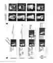 Fig. 20 - Agent for capturing tumor cells and methods of use thereof