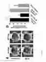Fig. 22 - Agent for capturing tumor cells and methods of use thereof