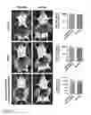 Fig. 23 - Agent for capturing tumor cells and methods of use thereof
