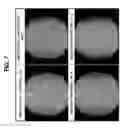 Fig. 08 - Enhancing health in mammals using telomerase reverse transcriptase gene therapy