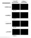 Fig. 07 - Compositions comprising angiogenic factors and methods of use thereof