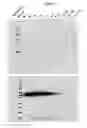 Fig. 03 - Vaccines based on hepatitis B core antigens