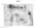 Fig. 08 - Vaccines based on hepatitis B core antigens