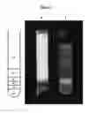 Fig. 10 - Vaccines based on hepatitis B core antigens