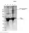 Fig. 11 - Vaccines based on hepatitis B core antigens
