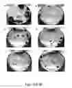 Fig. 07 - Compositions, methods and uses for dengue virus serotype-4 constructs