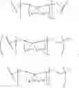 Fig. 229 - Crosslinked gels comprising polyalkyleneimines, and their uses as medical devices