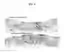 Fig. 05 - Biocompatible scaffolds with tissue fragments