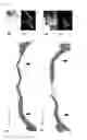 Fig. 03 - Bone regeneration material