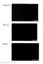 Fig. 10 - Bioengineered allogeneic blood vessel