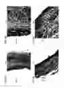 Fig. 16 - Bioengineered allogeneic blood vessel