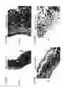 Fig. 17 - Bioengineered allogeneic blood vessel
