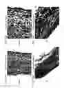 Fig. 18 - Bioengineered allogeneic blood vessel