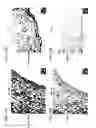 Fig. 20 - Bioengineered allogeneic blood vessel
