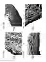 Fig. 24 - Bioengineered allogeneic blood vessel