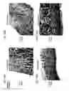 Fig. 25 - Bioengineered allogeneic blood vessel