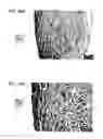 Fig. 29 - Bioengineered allogeneic blood vessel