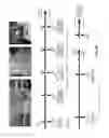 Fig. 12 - Method of Preparing Artificial Organs, and Related Compositions