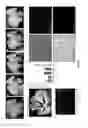 Fig. 19 - Method of Preparing Artificial Organs, and Related Compositions