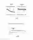 Fig. 13 - Systems and methods for treating acute and chronic heart failure