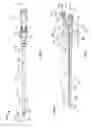 Fig. 02 - Dual lumen sheath for arterial access