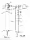 Fig. 02 - Device for percutaneous delivery of therapeutic agents, and a method for its use