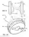 Fig. 14 - Device for percutaneous delivery of therapeutic agents, and a method for its use