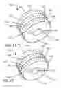 Fig. 15 - Device for percutaneous delivery of therapeutic agents, and a method for its use