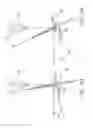 Fig. 27 - Oscillating positive expiratory pressure device