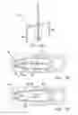Fig. 63 - Oscillating positive expiratory pressure device
