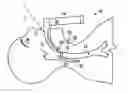 Fig. 01 - Intubation systems and methods based on airway pattern identification