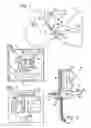 Fig. 02 - Intubation systems and methods based on airway pattern identification