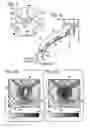 Fig. 03 - Intubation systems and methods based on airway pattern identification
