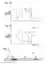 Fig. 04 - Intubation systems and methods based on airway pattern identification